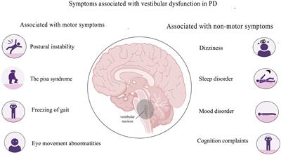 Vestibular dysfunction in Parkinson’s disease: a neglected topic